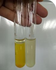 金葡菌种血浆凝固酶试验不凝固？常见原因与解决对策全解析